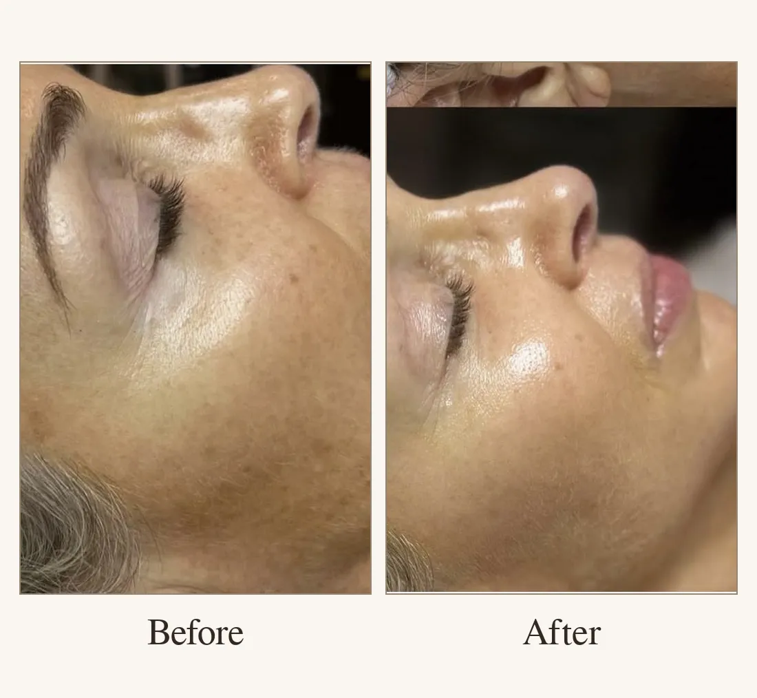 Uneven Skin Tone
