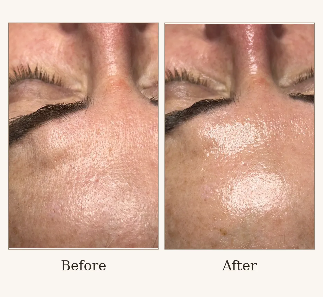 Dry & Dull Skin